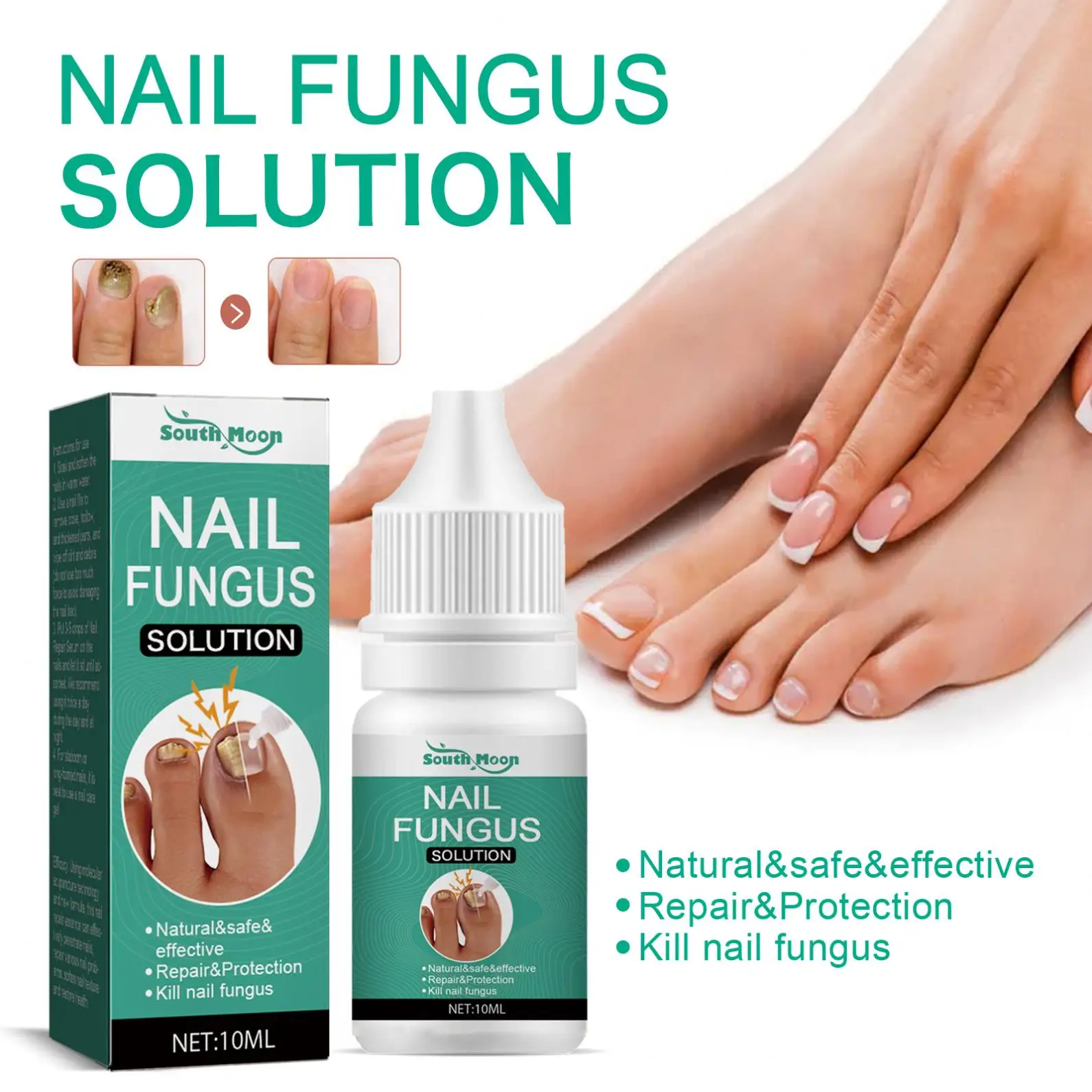 South Moon 10ml Nail Fungal Treatment Feet Care Foot Repair Nail Fungus Removal Serum Gel Anti Fungal Nail Repair Treatment