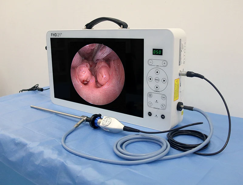 shrek endoscopy manufacturer medical fhd endoscopic system with 21 inch monitor and recording