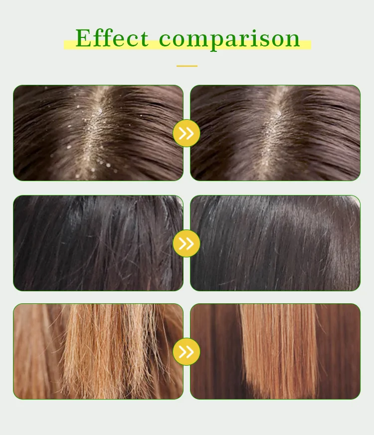 Hot sell natural organic private label hair growth smooth shampoo agran oil & tea tree oil shampoo and conditinoer set