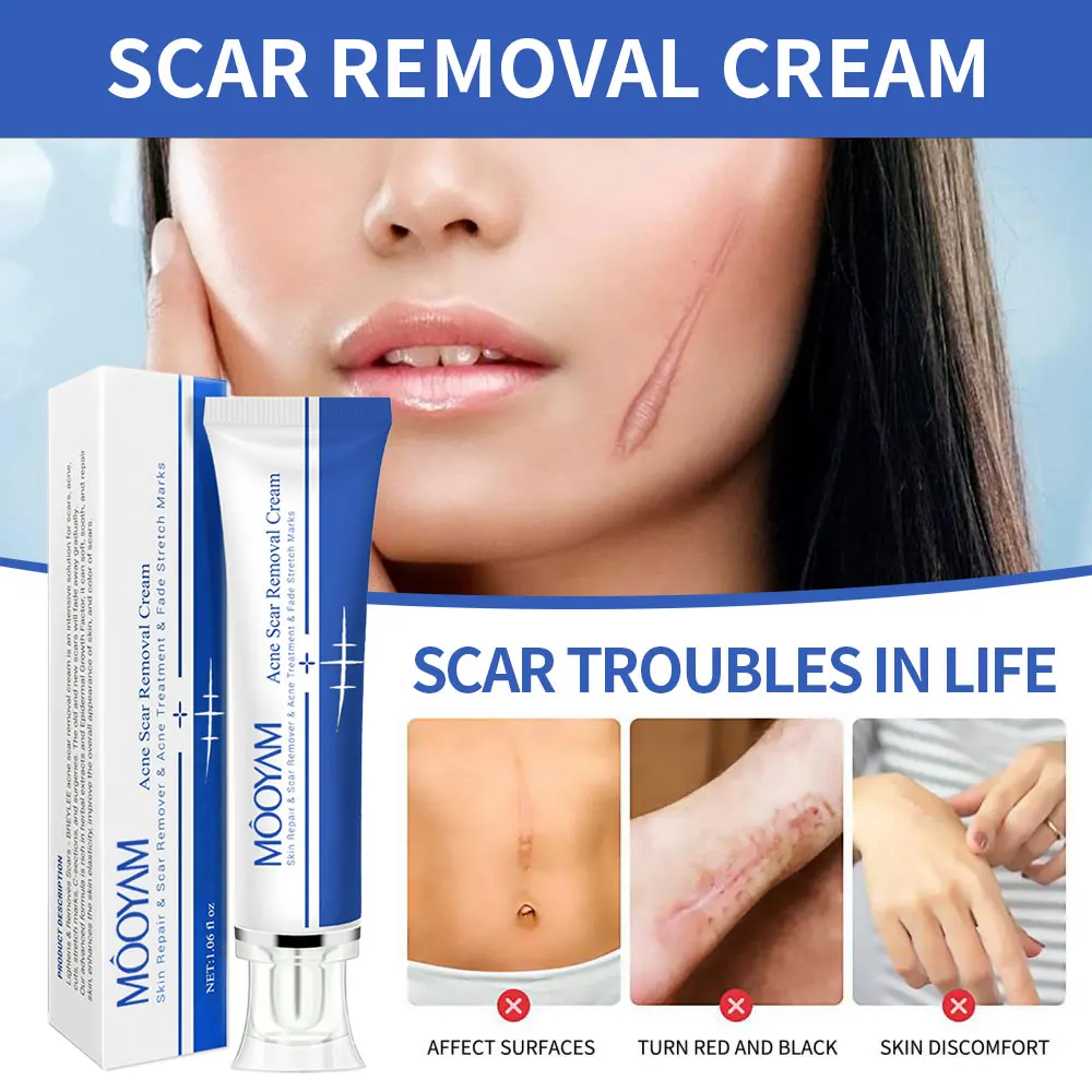 Strong Effective Acne Scar Removal Cream Pimples oem Face Gel Tummy Tuck Tightening Stretch Mark Removal Cream