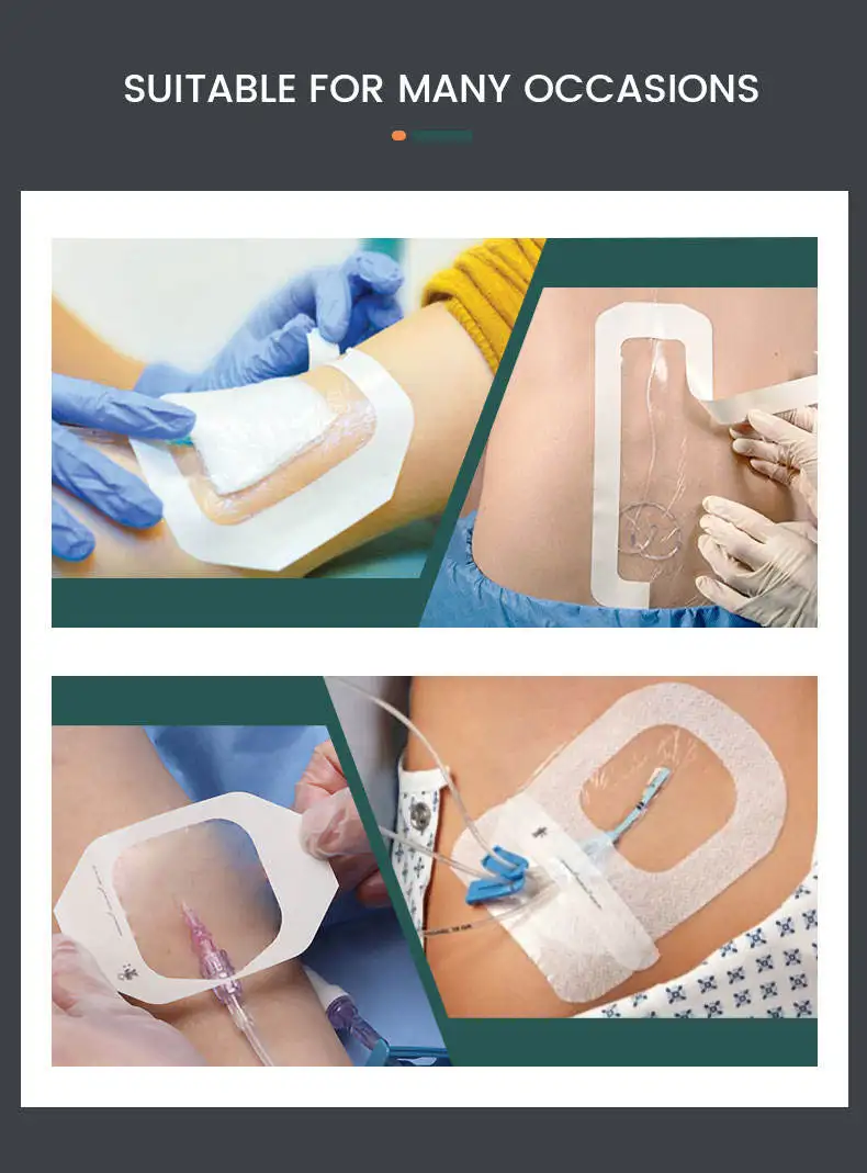 Высококачественное медицинское клеящее устройство для фиксации катетера прозрачные повязки на рану поверхности тела