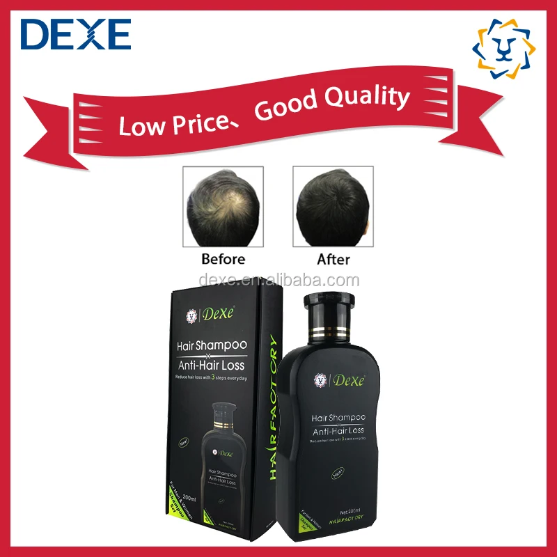 Name Brand Anti Hair Loss Shampoo India Adult ISO Male 10 Years Experience OEM ODM OBM Superior Accepted FT888-01