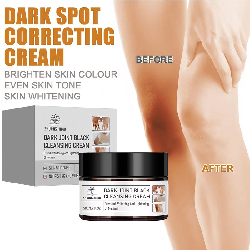 Body Whitening Cream Joint Underarm Legs Knee Elbow Brighten Armpit Bleaching Cream Remove Dark Spots Melanin Skincare Cream