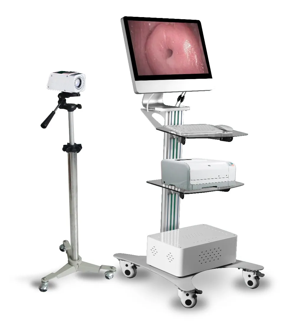 SW-3302 цифровой электронный Colposcope/Дешевые ccd камера colposcope/colposcope для женщин влагалище диагностики