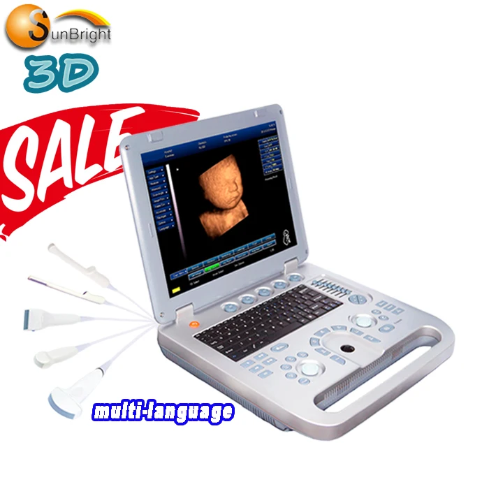 SUN-800D 3D портативный медицинский сканер mindray m9 ультразвуковая