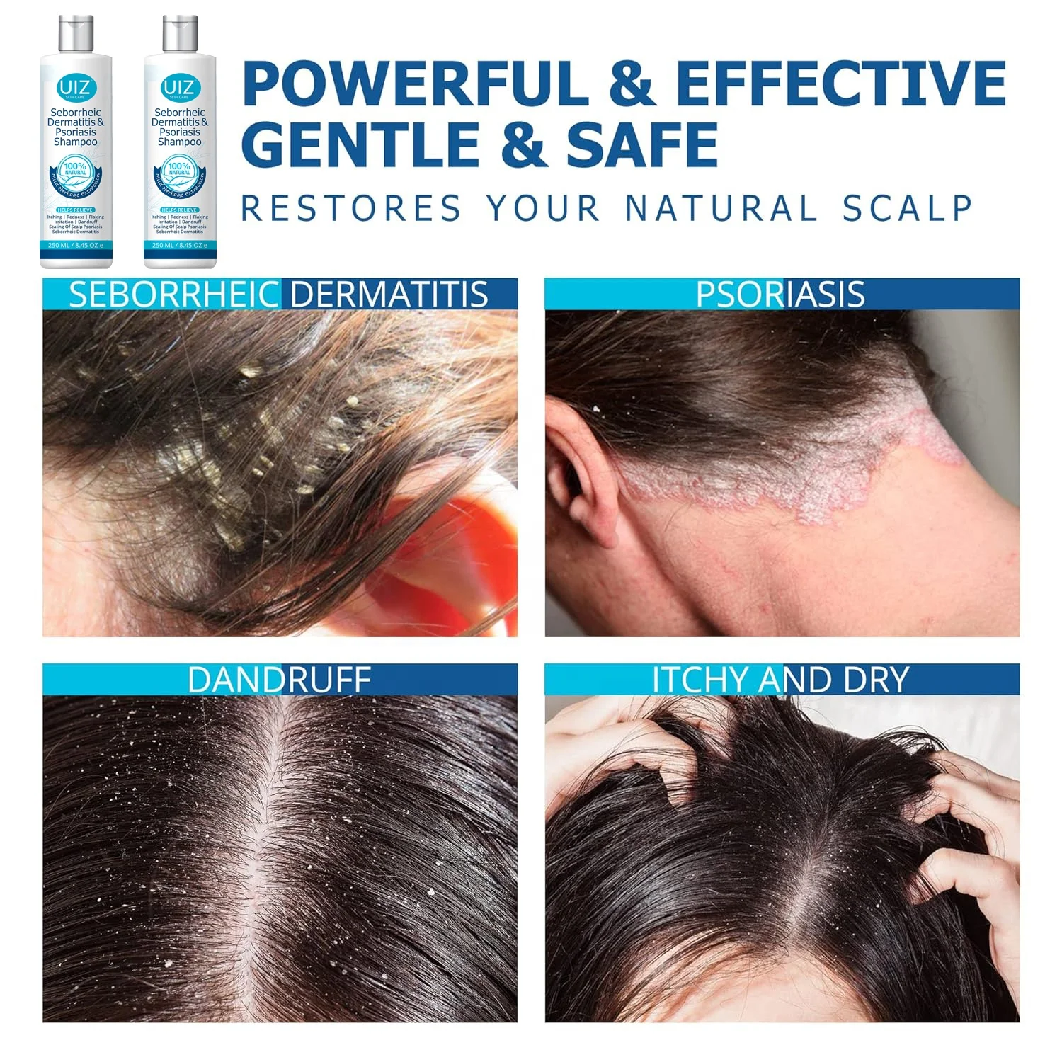 Folliculitis Psoriasis Shampoo Deep Cleaning Anti Dandruff Scalp Seborrheic Dermatitis Dry Itchy Treatment Hair Shampoo
