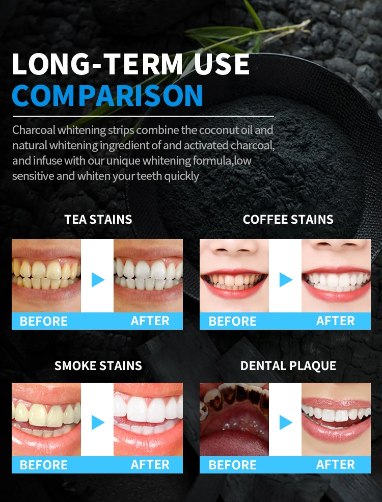 PAP+ Charcoal Whitening Teeth Strips Private Label Professional Whitening Strips for Enhanced Teeth Whitening