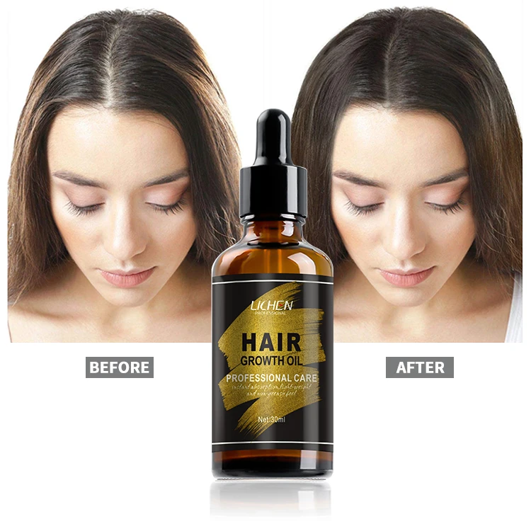 Низкий минимальный заказ, частная марка, 7 дней, экстремально быстрый рост черных волос, поставщики масла для женщин и мужчин