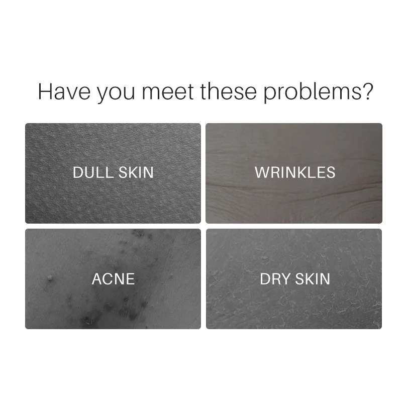 Relax, Lift, Tighten and Improve Wrinkles Azelaic Acid 10% Facial Essence