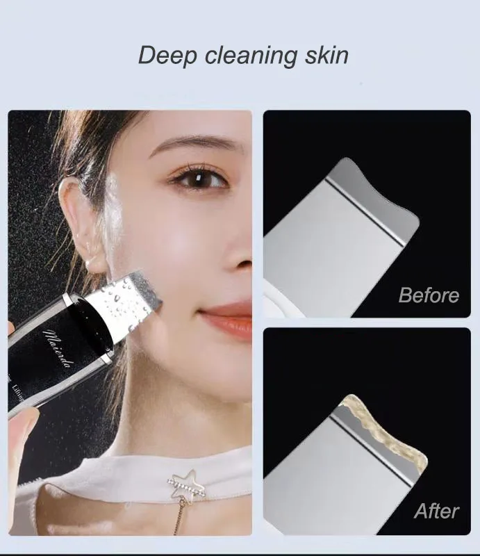  Ultrasonic skin scrubber face cleaning peeling care