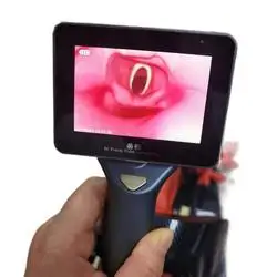 aneasthesia endoscope