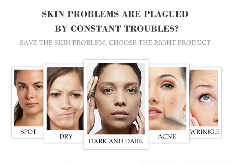Effective Whitening Freckle Cream Remove Melasma Acne Spot Pigment Melanin Dark Spots Pigmentation Moisturizing Whitening Cream