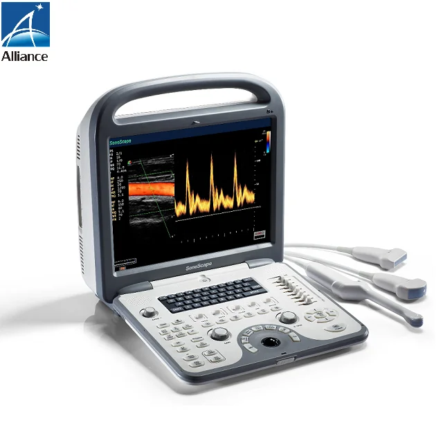 Sonoscape S6 Portable 4D Color Doppler Ultrasound For Human