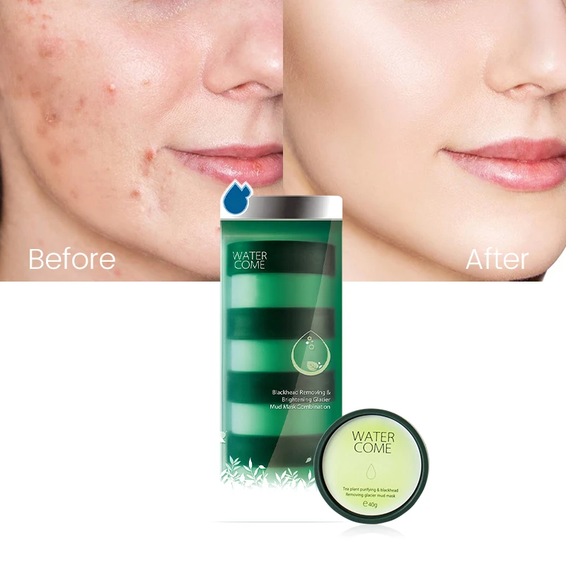 Wholesale 40g  4pcs Moisturizing Deep Cleaning Anti-acne Clay Mask Collagen Brightening Mud Facial Mask