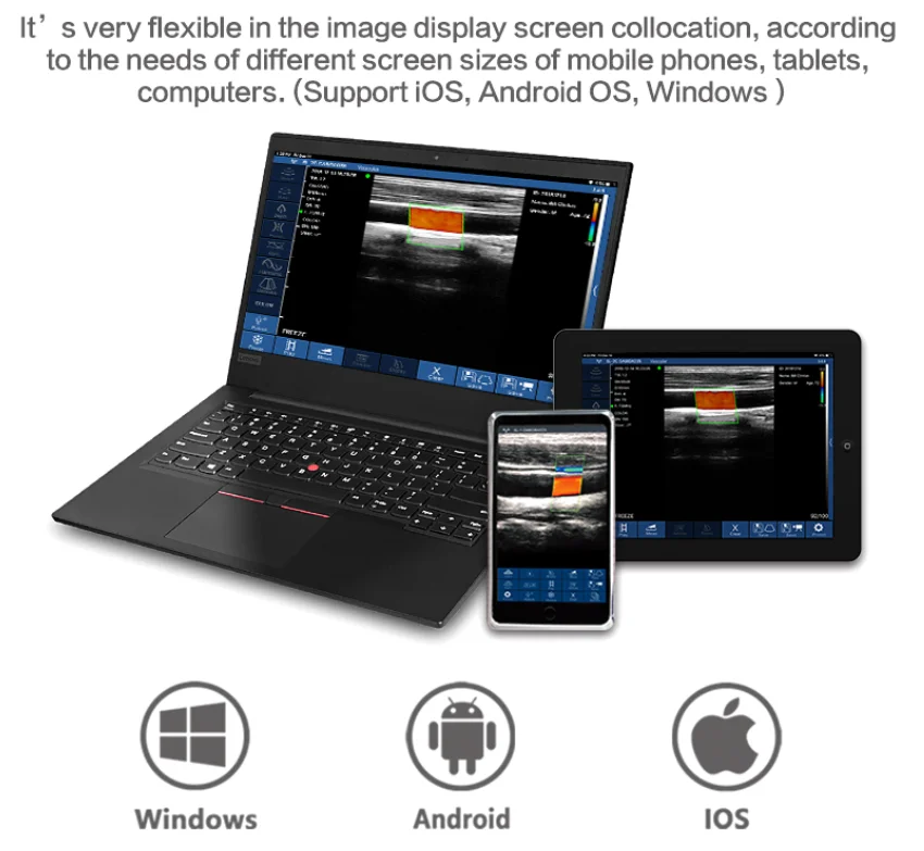 Ручной линейный выпуклый поэтапный массив 3 в 1 двойные зонды WiFi ультразвуковой зонд