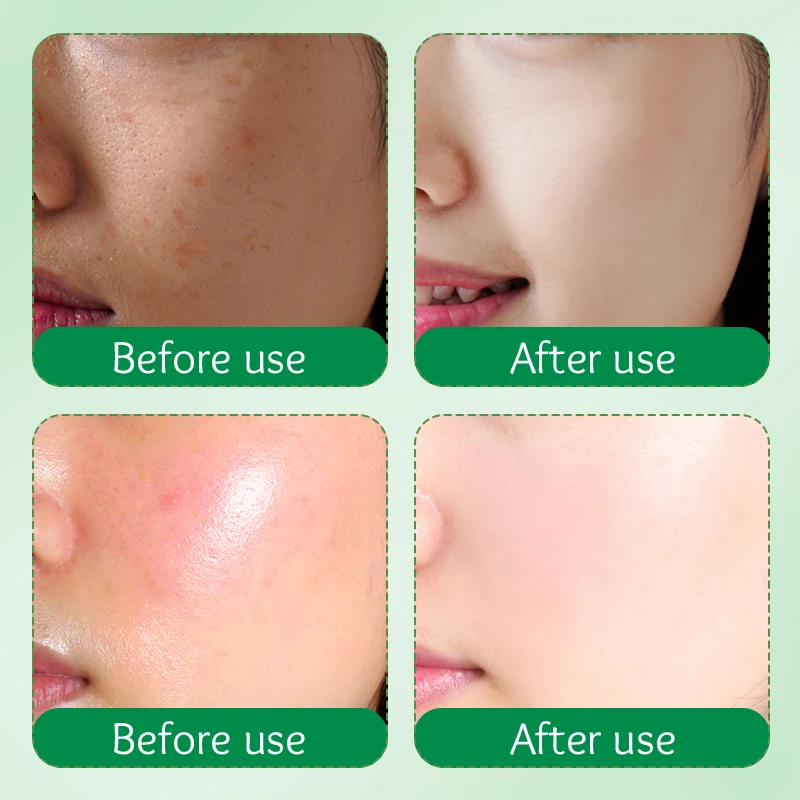 OEM SADOER Private Label Plant Nourishing Skin Care Products Milk Avocado Deep Hydrating Soothing Moisturizing Facial Cream