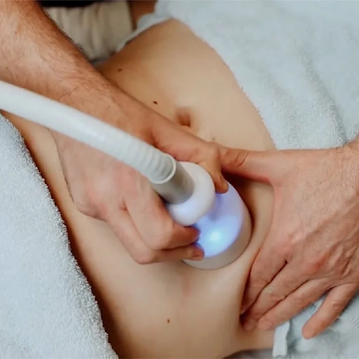 Registered appearance vacuum weight loss device body slimming cryoskin slimming toning hot cold cryo skin tightening machine