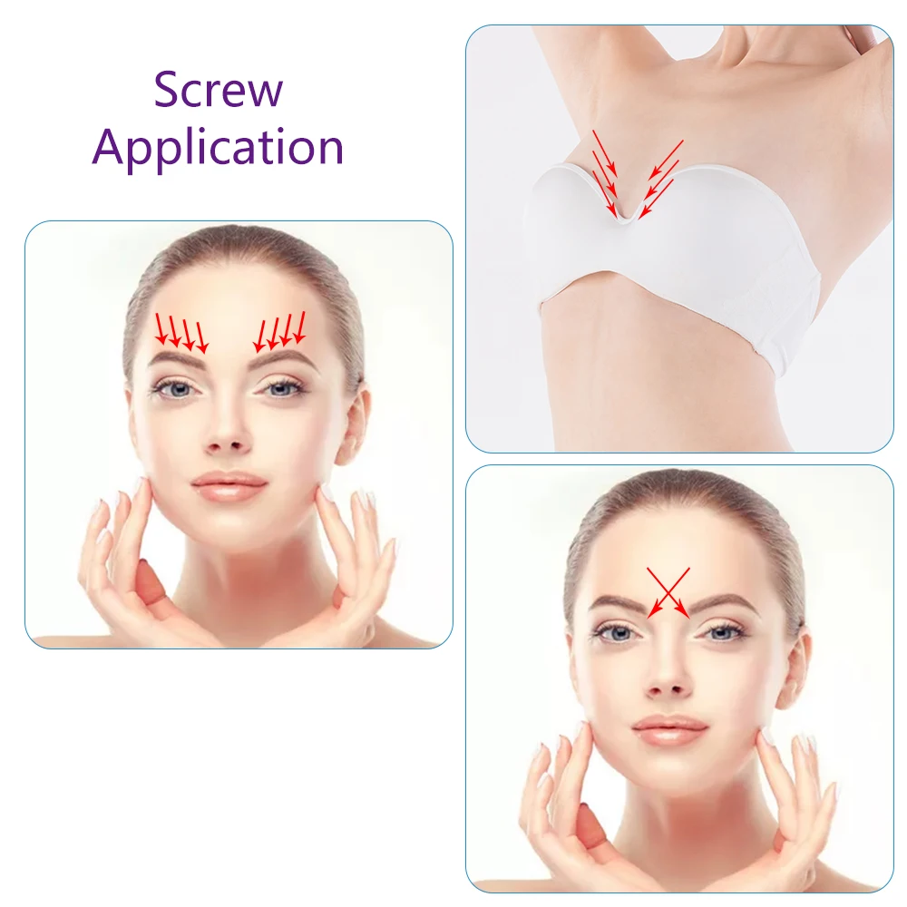  2021 Quality Supply Disposable Cosmetic Micro Sharp Tip 29g 25mm Mono Screw Pdo Face Body Lift Filling