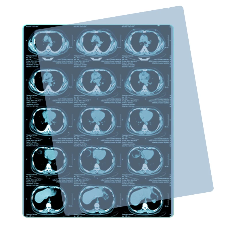 Medical Printing Radiology Universal Dry Film / 8*10 Inch Medical Blue Thermal Film/X-ray Printer hospital Film