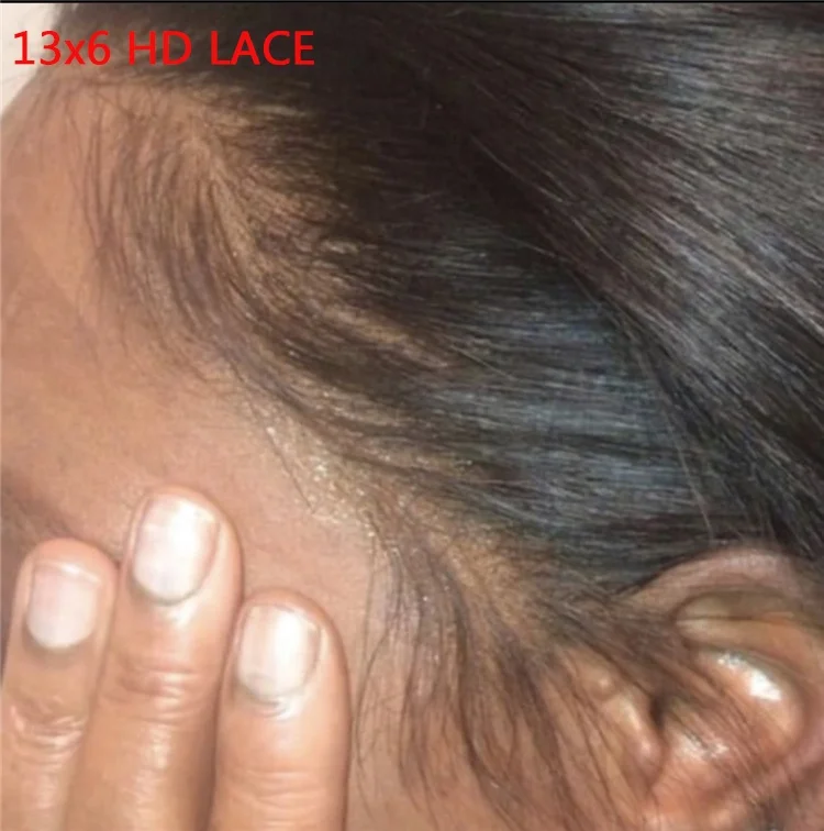 
5x5 13x4 13x6 Hd Lace Vendor Brazilian Virgin Cuticle Aligned Swiss Hd Lace Frontal 100% Human Hair Hd Lace Front 