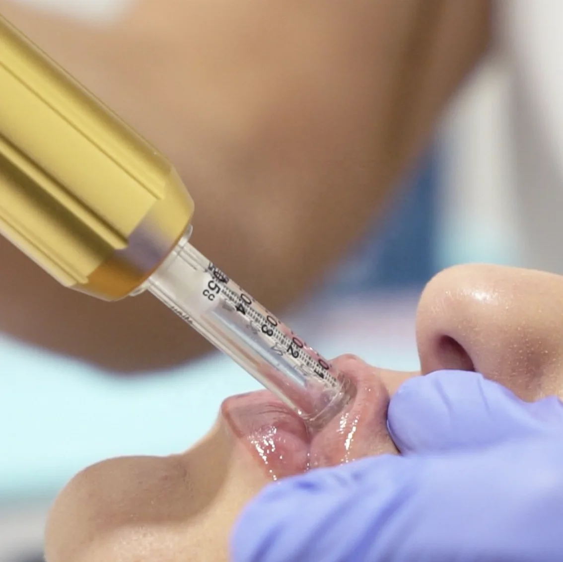 Automatic injector Facial corporal caneta pressurizada lip filler hyalurone pen