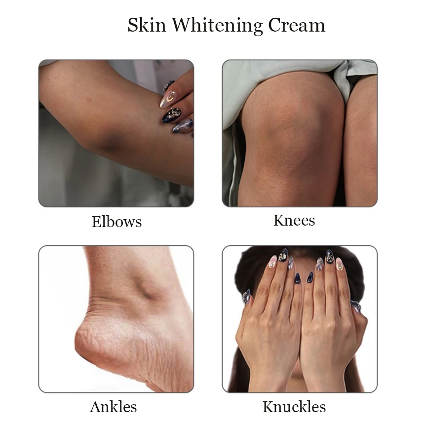 Hot sales Private label OEM skin moisturising lightening body bleaching  dark spot removing skin whitening cream