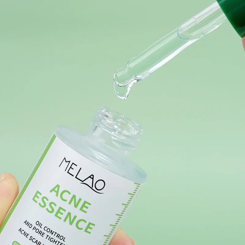 skin care acne treatment Natural Organic acne serum for acne remover scar lightening reduce blackheads