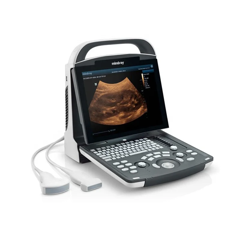 Original  factory supply black white handled ultrasound scanner mindray dp 10 ultrasound