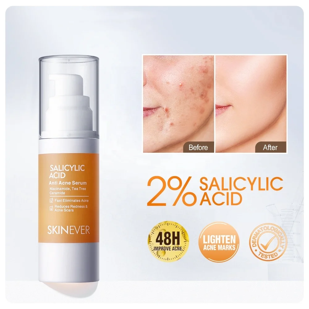 SKINEVER Salicylic Anti Acne Serum fast eliminates acne reduces redness and acne scars face serum