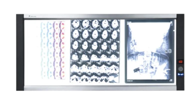 Micare DQ-2B 60w led double viewer  Hospital special orthopedic heart center X-ray source examination lamp