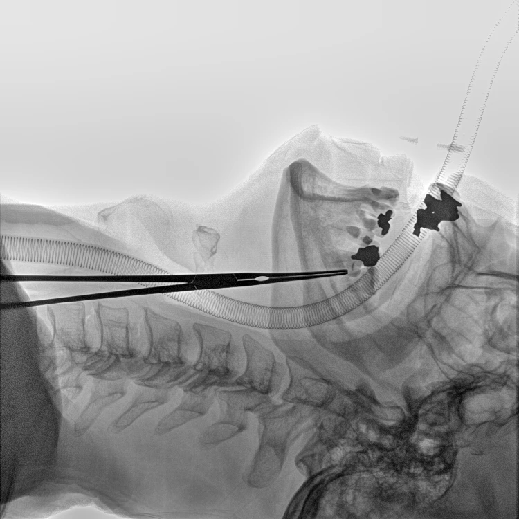 Reliable power and dose management Mobile C arm x ray system for hospital use
