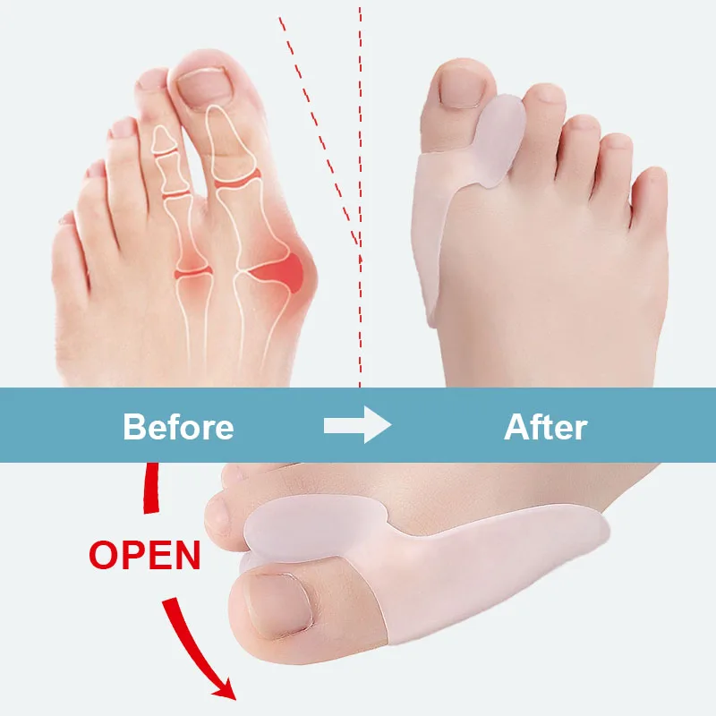 Custom Packaging Silicone Gels Bunion Toe Corrector Toe Separator Toe Spacers For Bunion Relief Bunion Protector