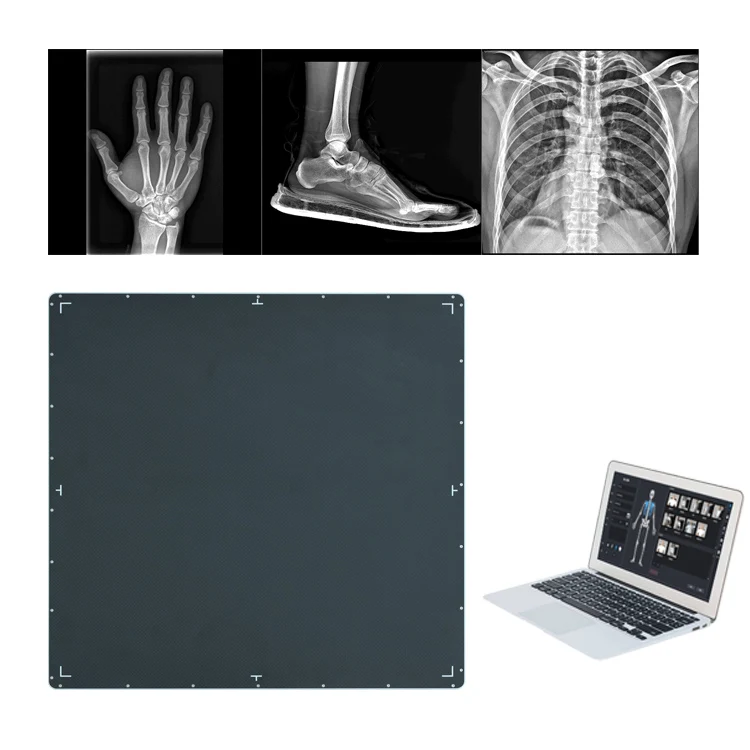 Плоская панель детектор рентгеновского радиологического оборудования dr digital xray машина радиография 17x17 беспроводной плоскопанельный