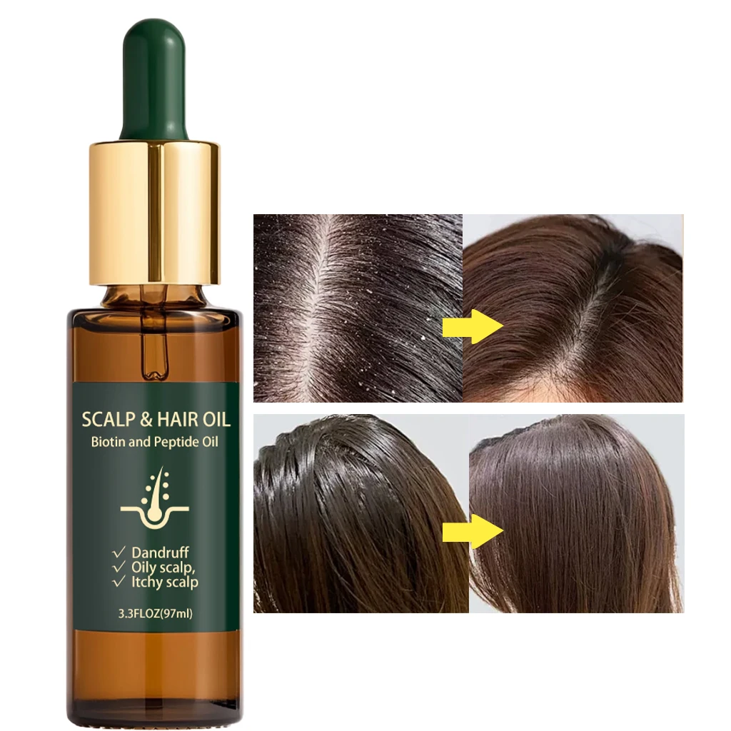 Natural plant hair scalp massage essential oil, activates the scalp, repairs damaged hair, reduces dandruff and scalp itching
