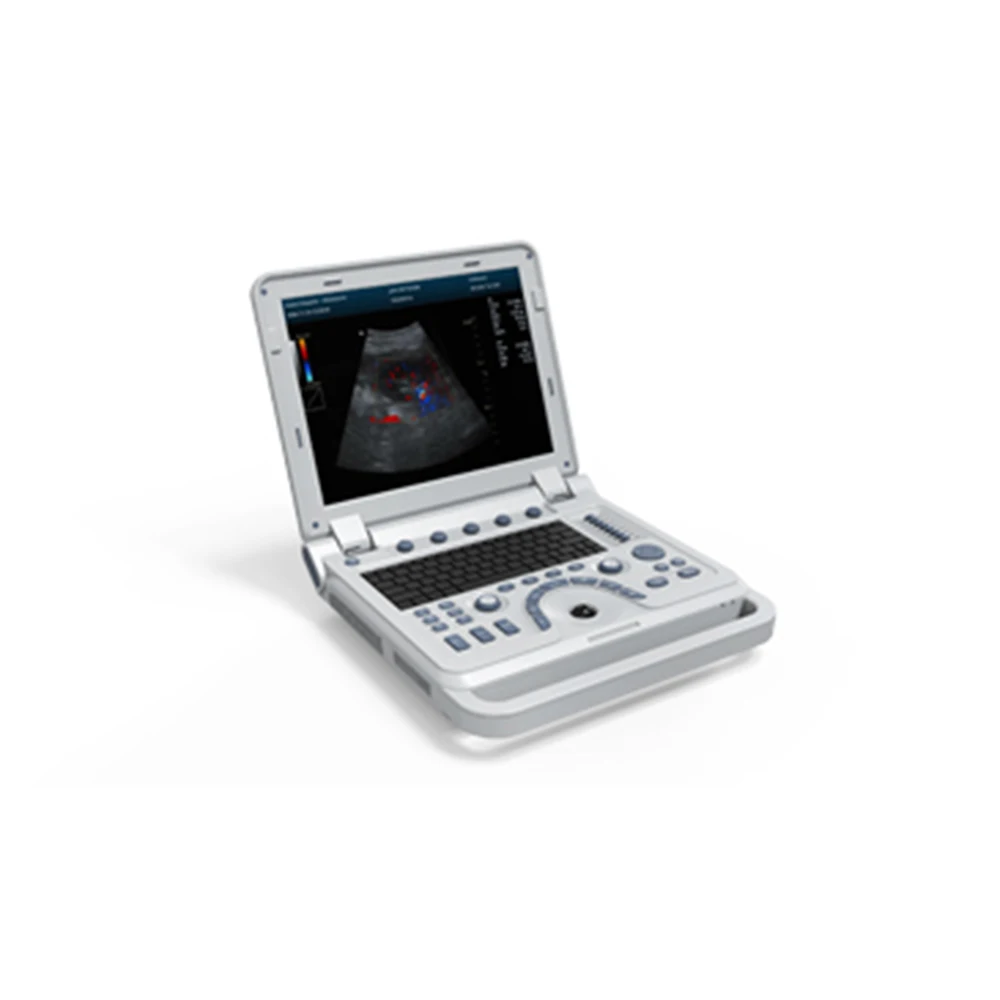Contec CMS600P2PLUS portable ultrasound machine pseudo Color Doppler Ultrasonic Diagnostic System