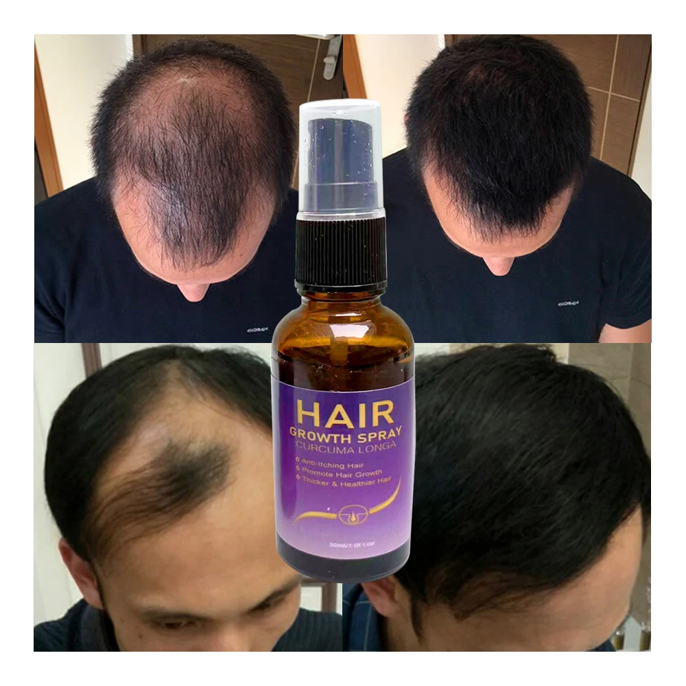 New Ginger Hair Care Growth Serum Hair Loss Treatment Spray 7 Days Effective Germinal Hair Growth Essential Oil