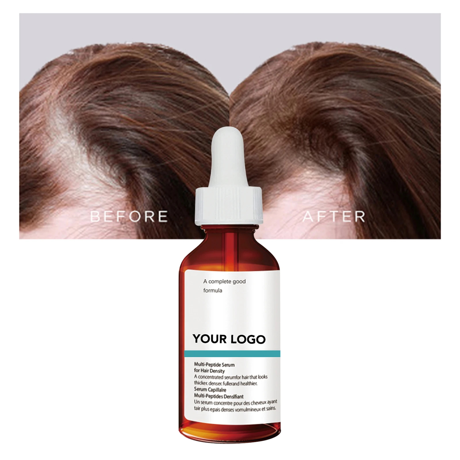 custom hair loss tonic polygonum multiflorum multi-peptide density regrowth hair growth serum