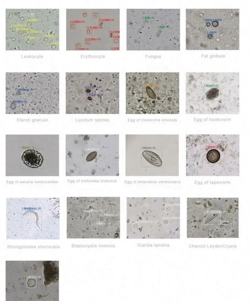 Dual Channel Automated Feces Analyzer/Analyzes of A Jar of Feces