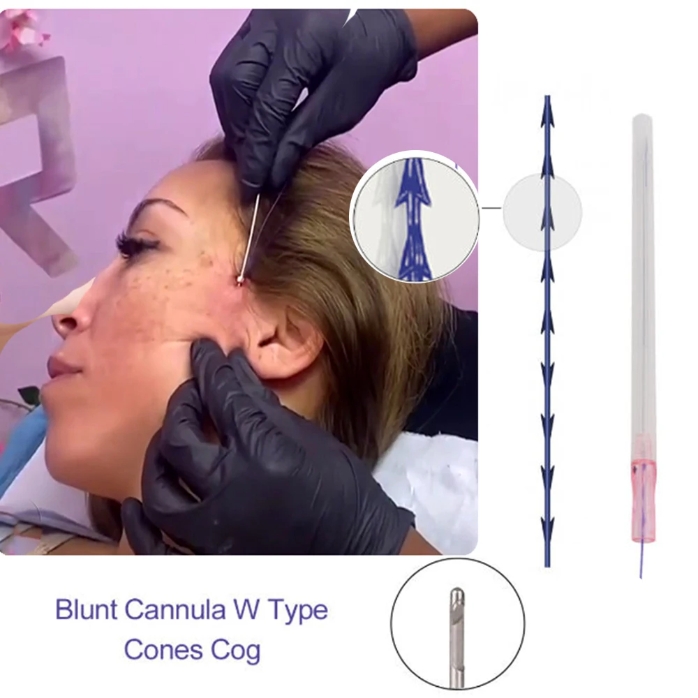 Non-Surgery Absorbable 19G 100mm Blunt W Needle Face Lifting Fishbone Molding Cog Pdo Thread