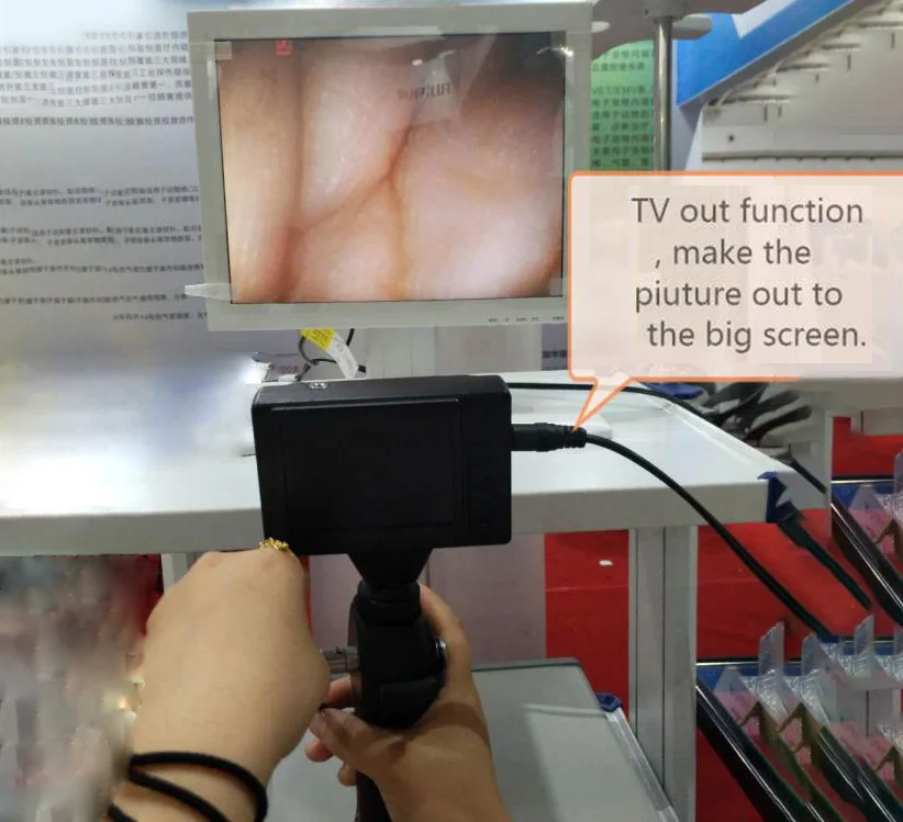 
Waterproof fiber optic flexible cystoscope camera medical full HD endoscopic camera system 