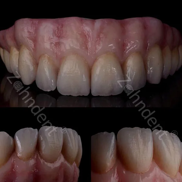 China Dental Medical Supplier Zirconia Blank Zahndent HT-Plus-Color Dental Laboratory