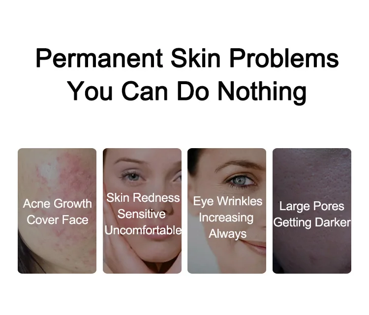 Wholesale Plasma Beauty Equipment Tightening Face Acne Treatment Rejuvenation Plasma Treatment Device