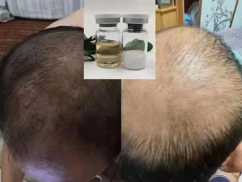 Regeneration hair growth freeze-dried powder stem cell factor hair repair anti-hair loss peptide solution natural scalp essence