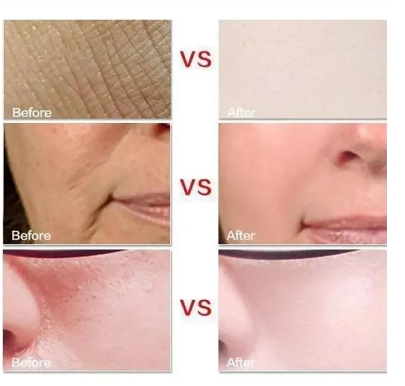 Wholesale  Organic Beauty Moisturizer Whitening  Gentle Nourishment  Brightening 92% Aloe Vera Gel  Face Cream