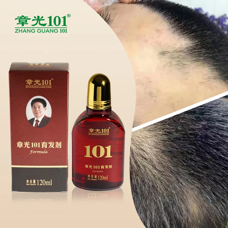 Private Label Natural Hair Care Hair Growth Serum for Men and Women