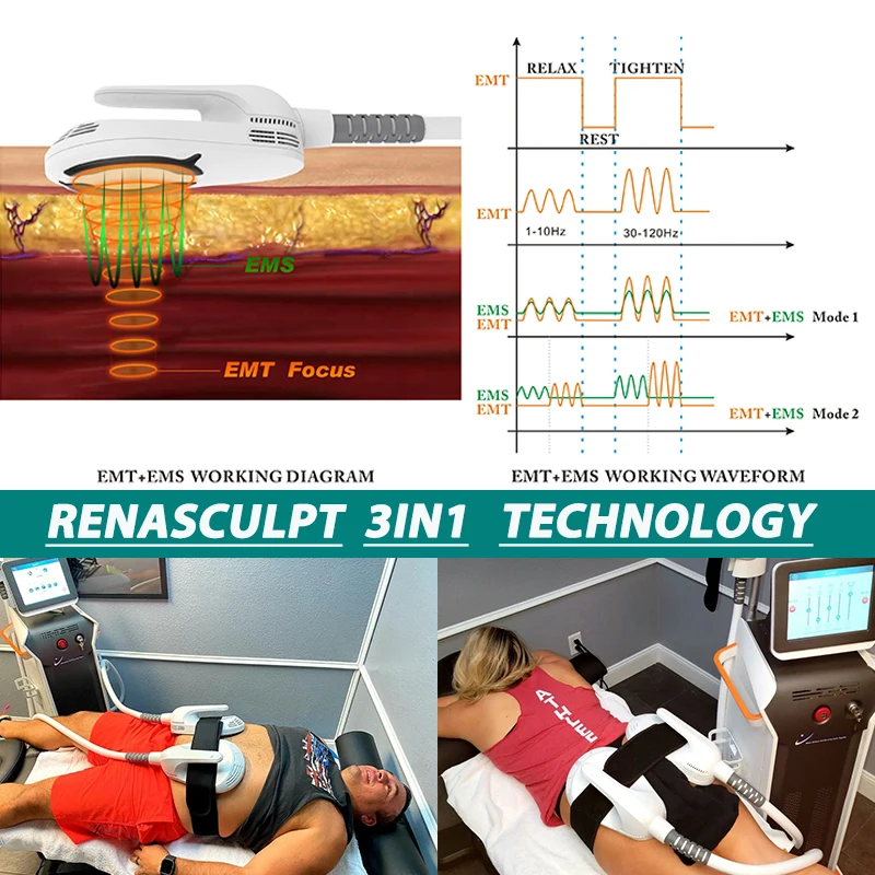 Winkonlaser Ems Neo Body Sculpt Fat Reduction Butt Lifting Fat Burning Muscle Build Manufacturer Fat Reduction Ems Rf Machine