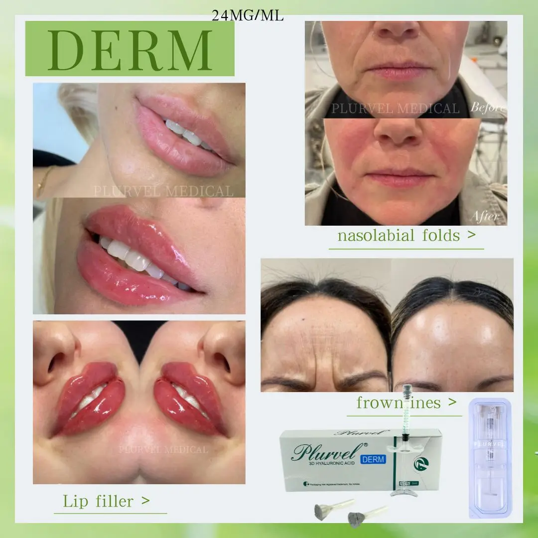 PLURVEL oem supported 1ml 2ml Fillers Injection Lip Face Hyaluronic Acid Gel / hyaluronic acid filling lips aesthetics