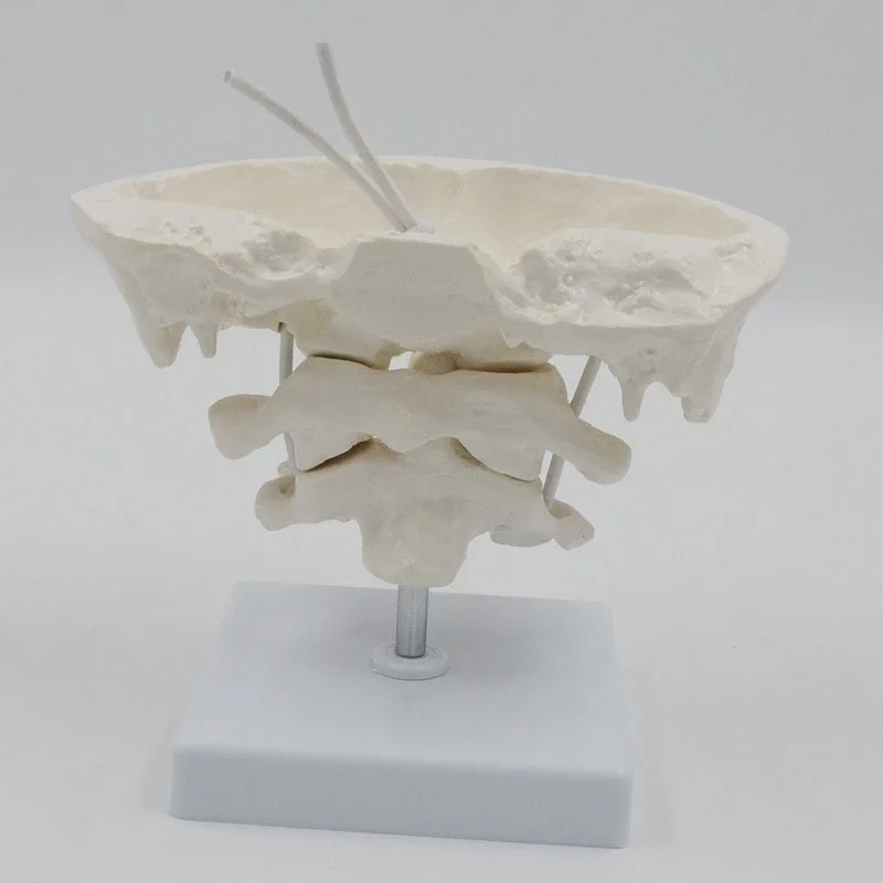 Detachable Human Occipital Bone Medical Anatomy Model With Atlas And Cardinal Vertebrae