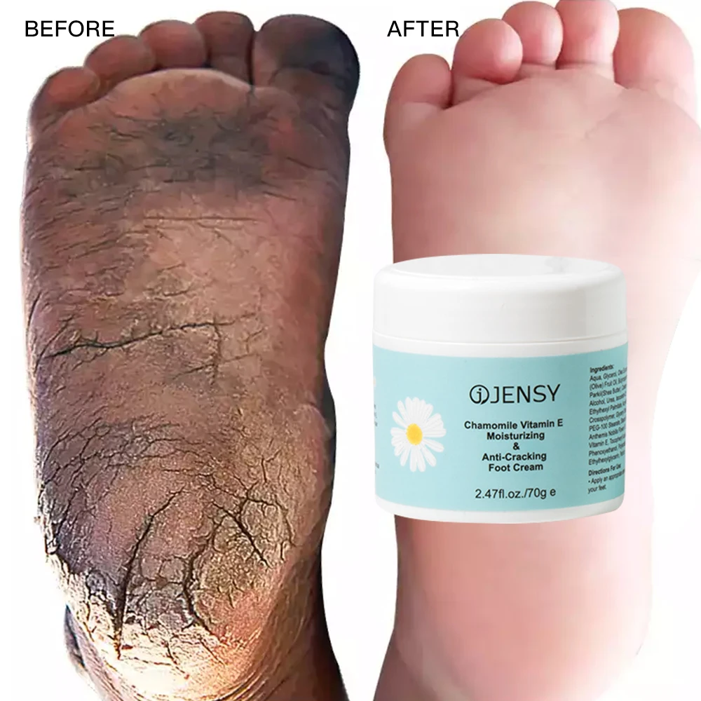 Custom peeling herbal dead skin removal vitamin c whitening vegan anti crack urea private label foot cream for cracked heels