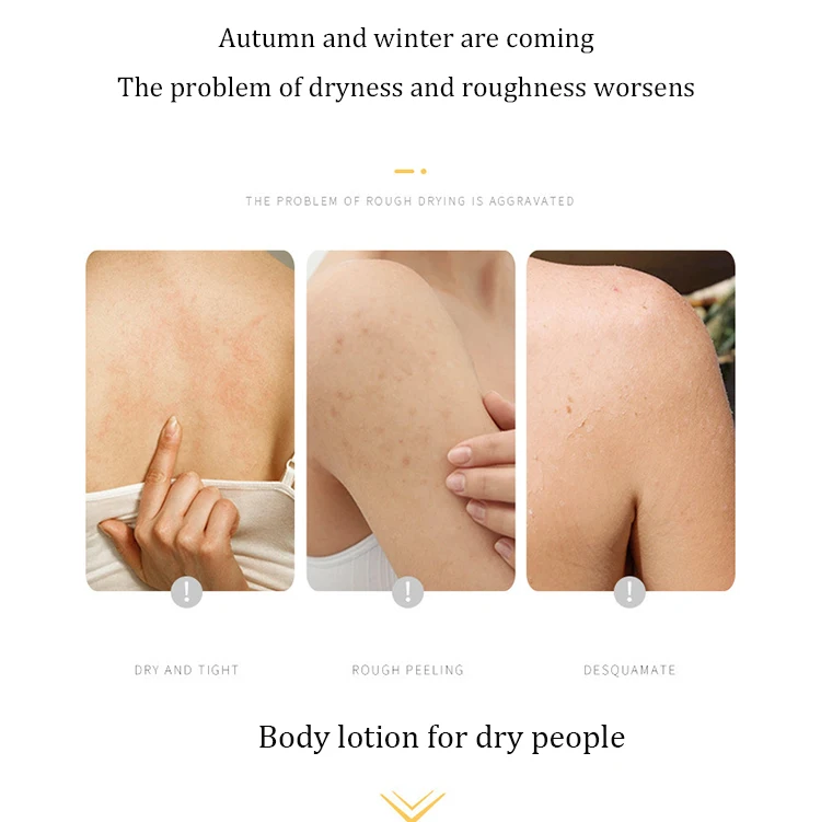 Hot Selling Natural Body Care Deep Moisturizing Anti-Drying Lotion Organic Lightening Whitening Goat Fat Body Lotion For Women